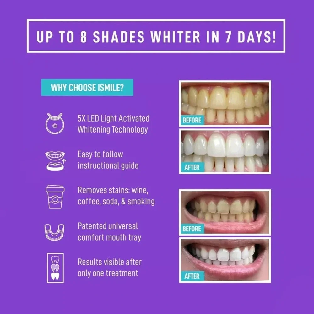 I Smile Professional Whitening Gel Portable Teeth Whitening Kit